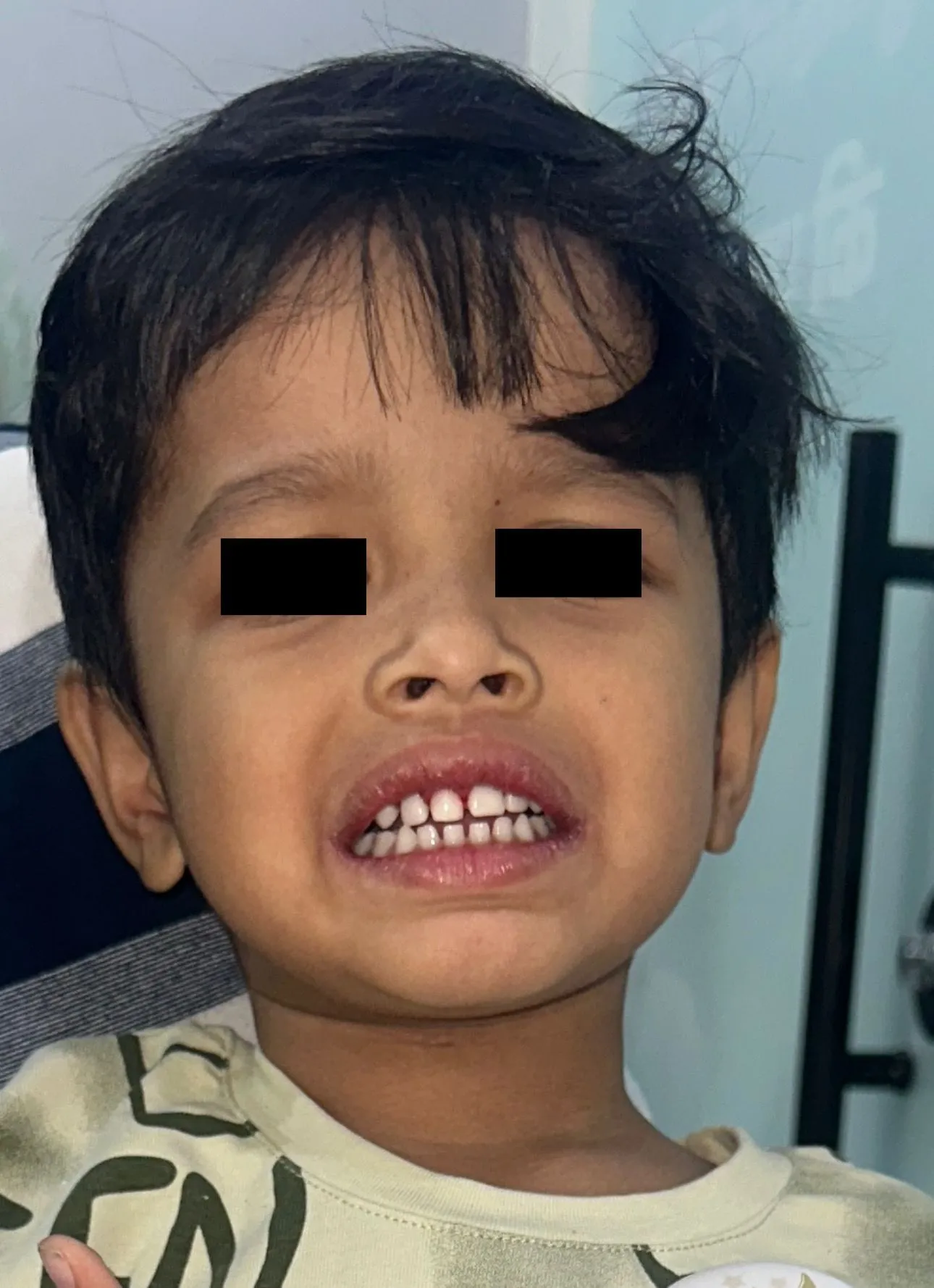 Jaw & Teeth Fracture Treatment